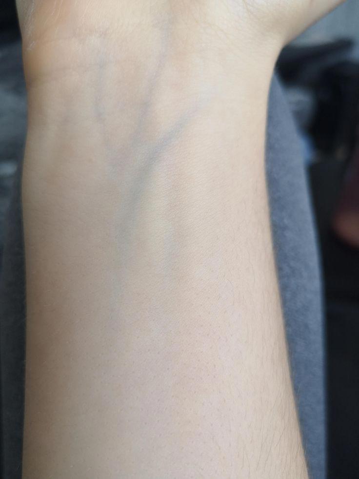 Why Are My Green Veins So Visible