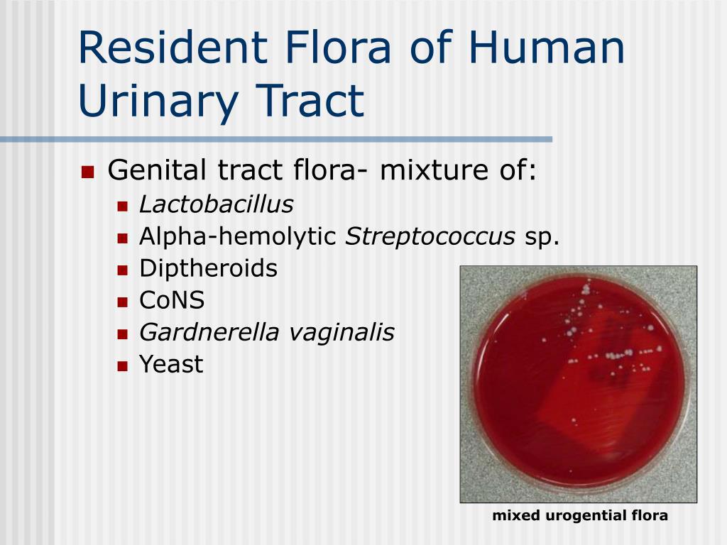 what-is-mixed-urogenital-flora