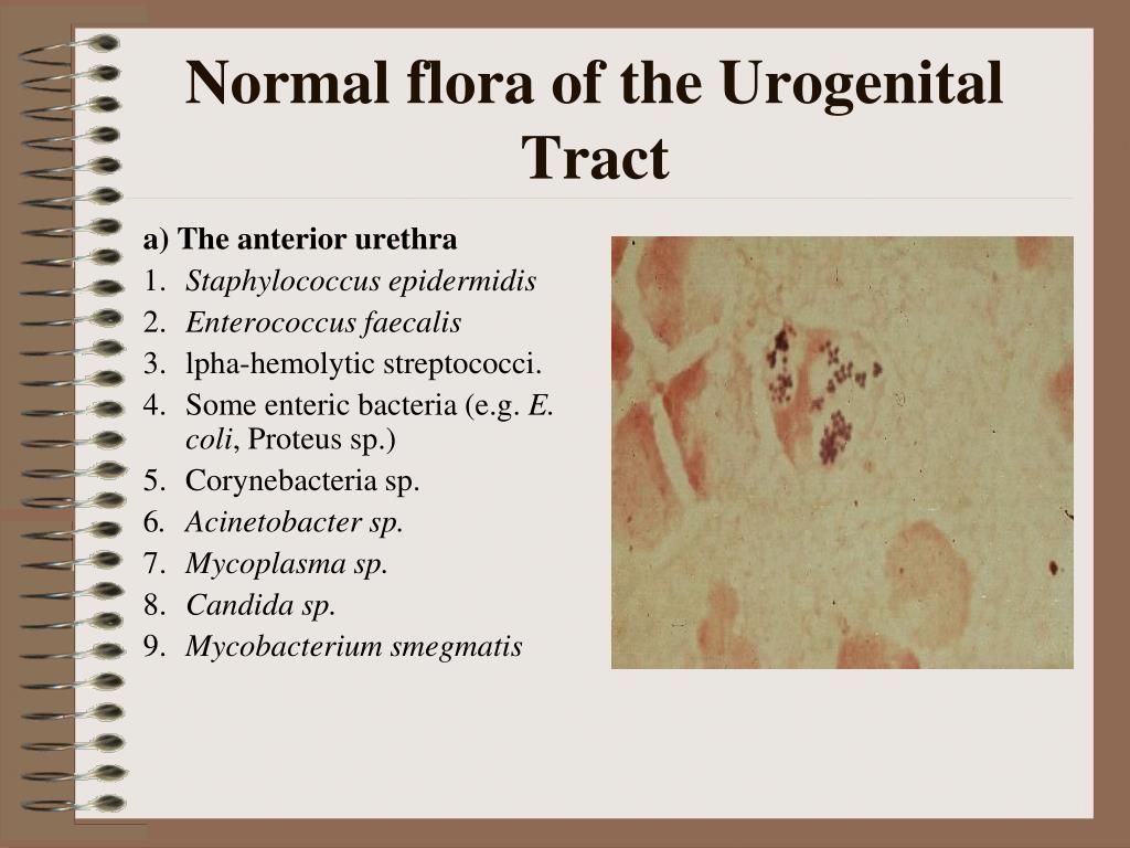 Is Urogenital Flora Normal