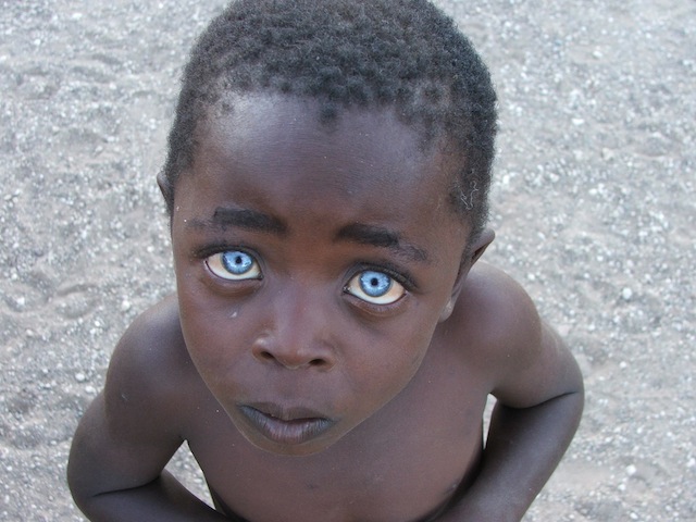 african baby with blue eyes 1674285128