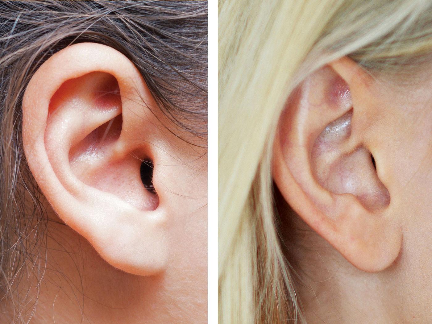 attached earlobes vs detached