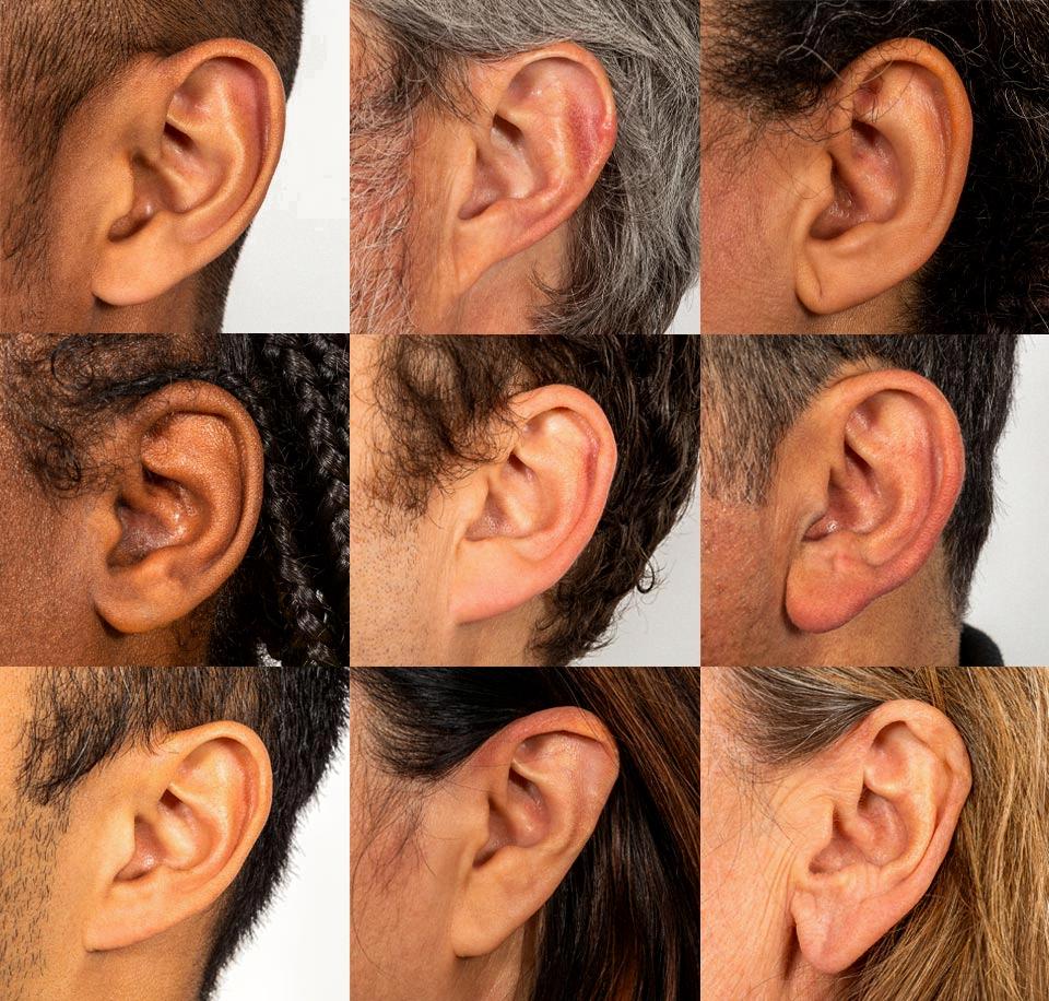 attached earlobes vs detached