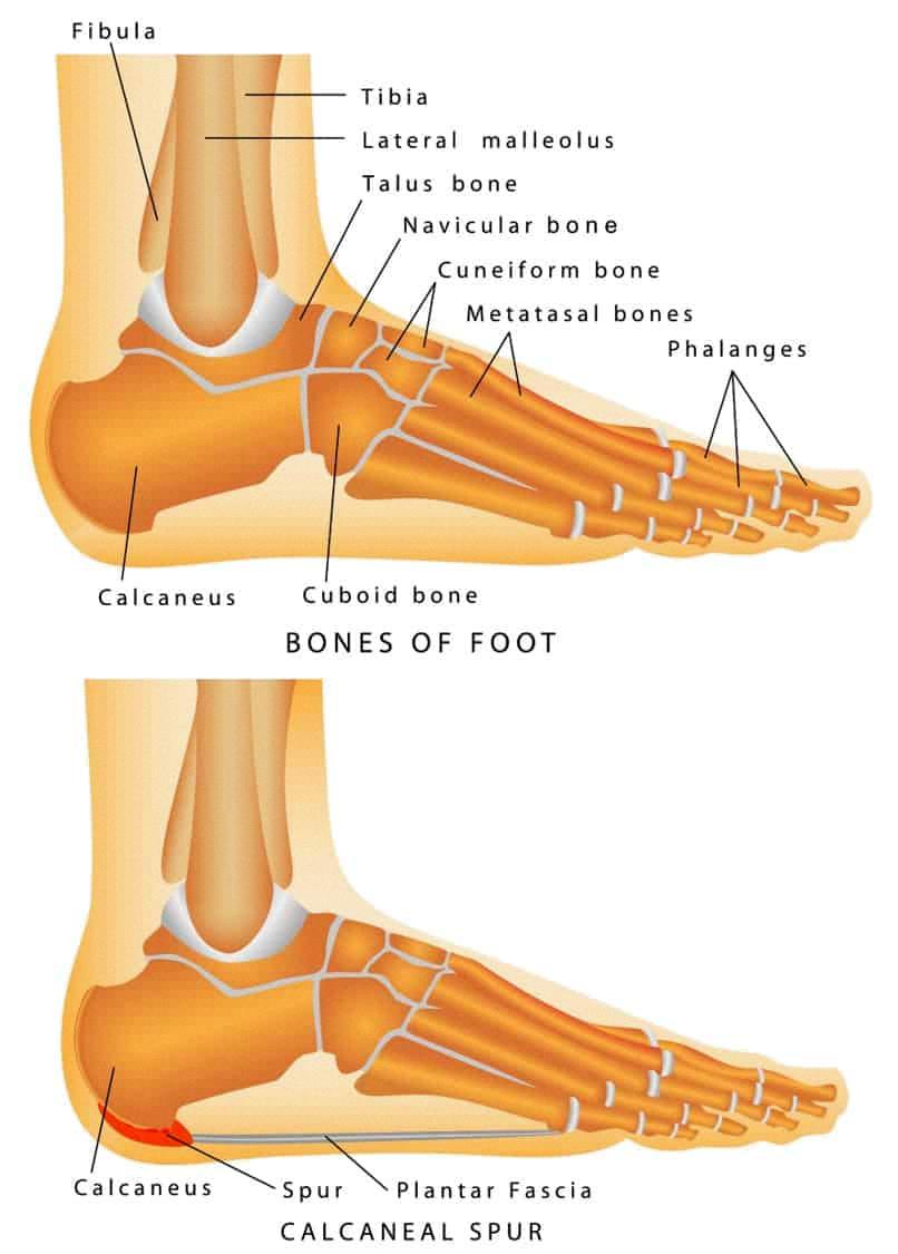 bunions-vs-bone-spurs-key-differences-and-treatments