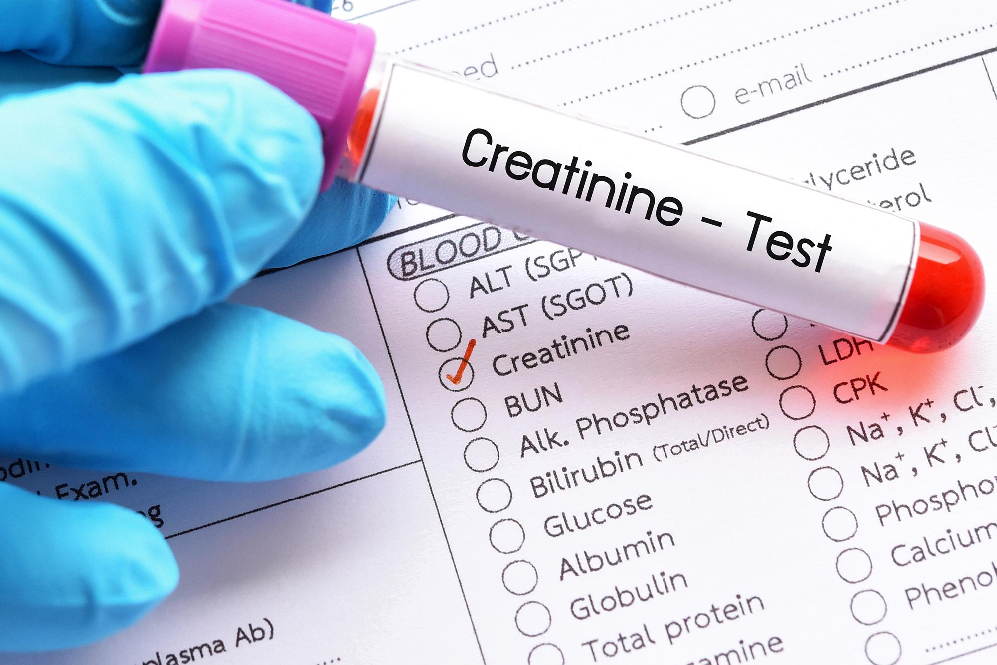 can creatinine levels change quickly