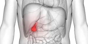 gallstone bowel movement 1674806722