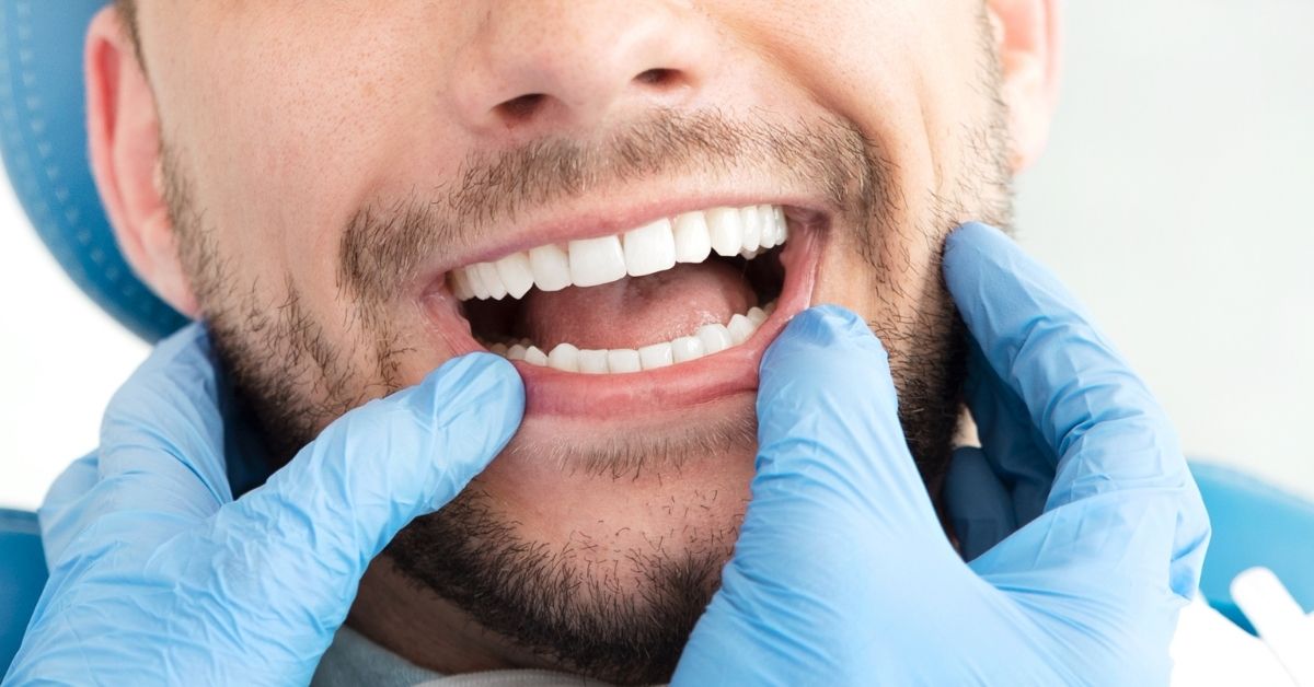 Smoking After Dental Filling What You Need to Know