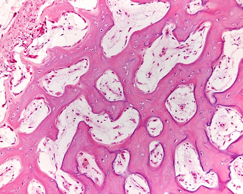 intramembrous ossification 1675963826