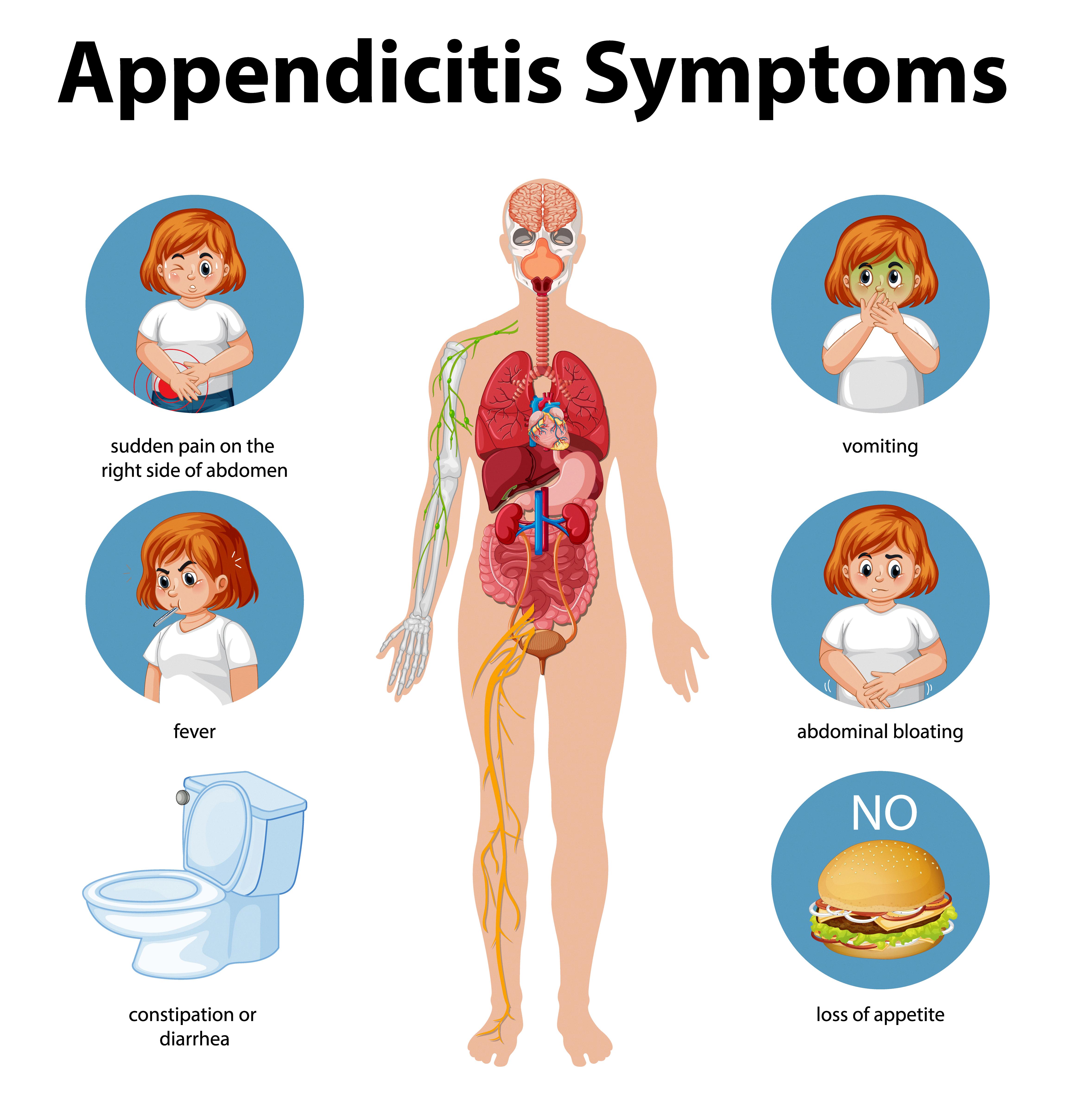 do i have appendicitis quiz