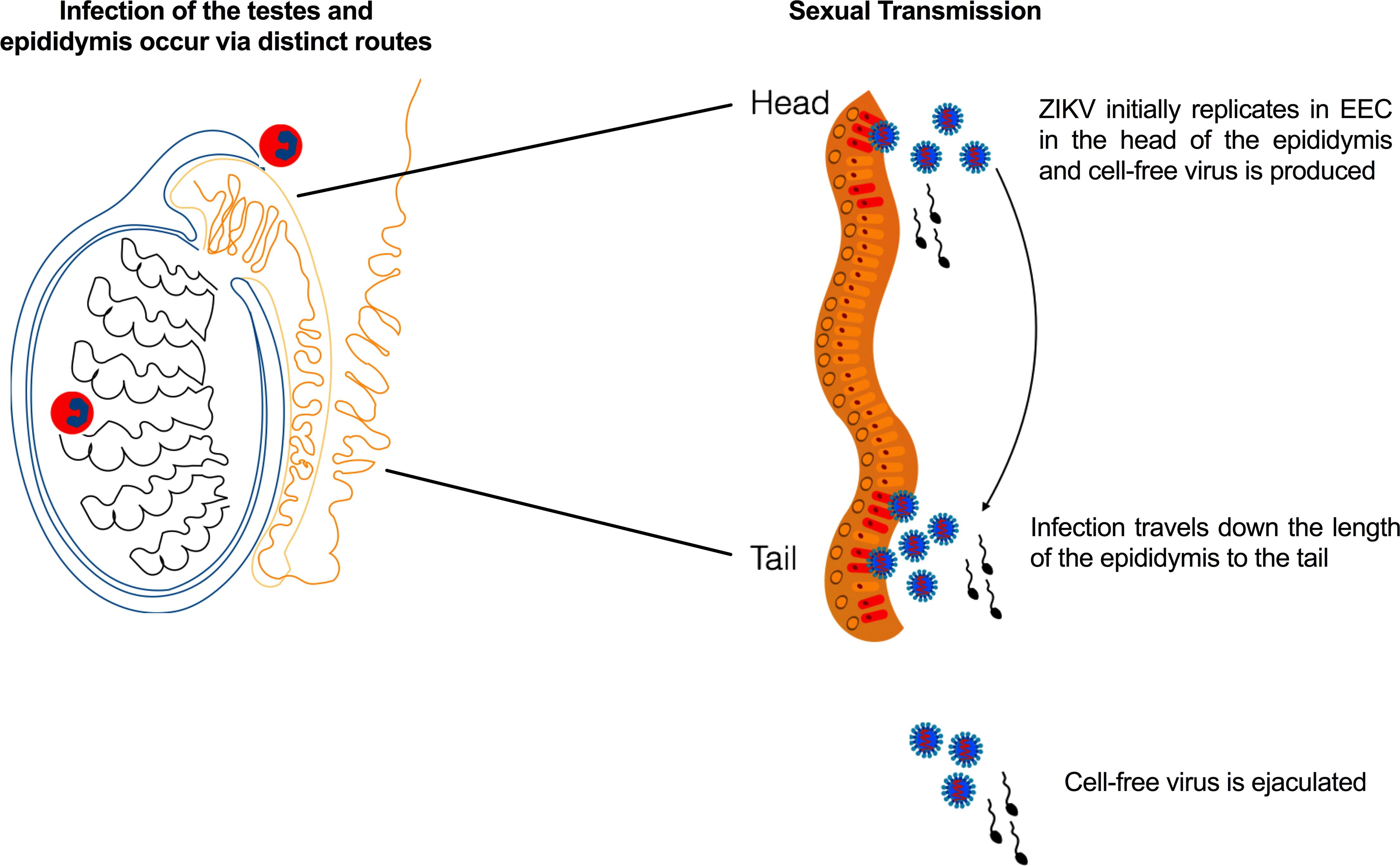 Management and Treatment Options For Epididymitis