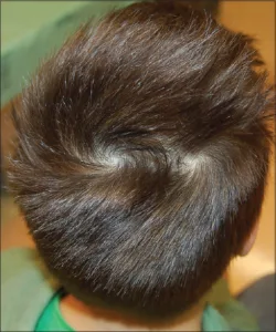double crown hair 1679819414