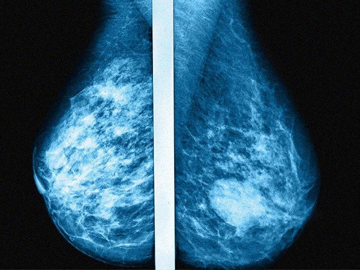 focal asymmetry should i be worried