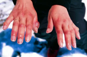 frostbite 1680874791
