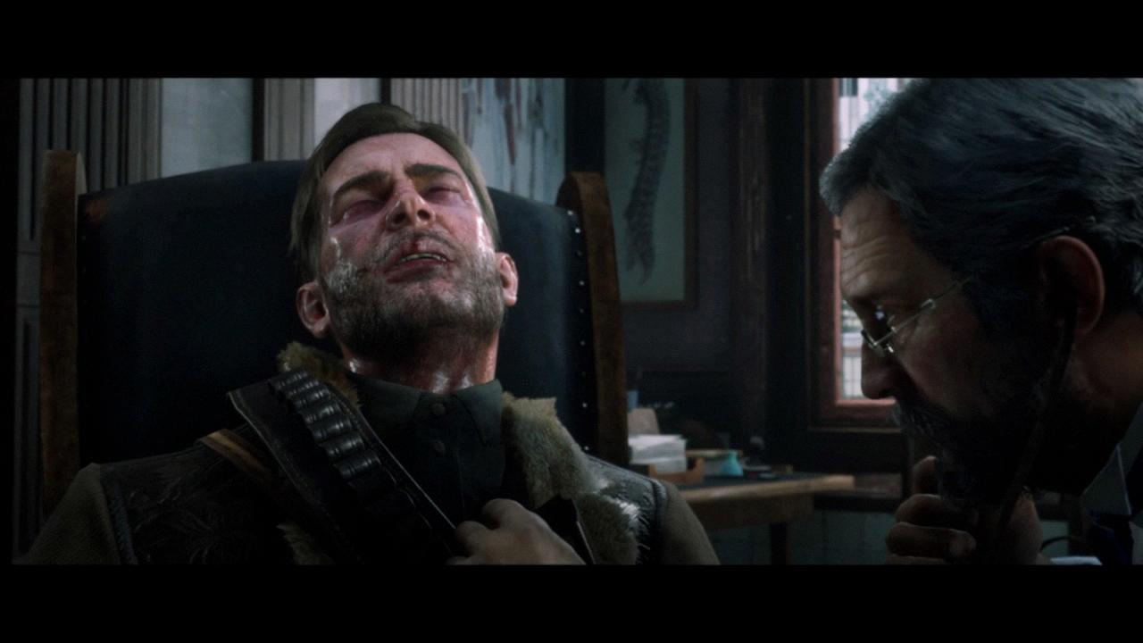 how did arthur morgan get tb