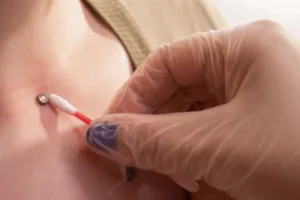 how do dermal piercings work 1 1