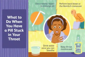 how long can a pill be stuck in your throat 1 1