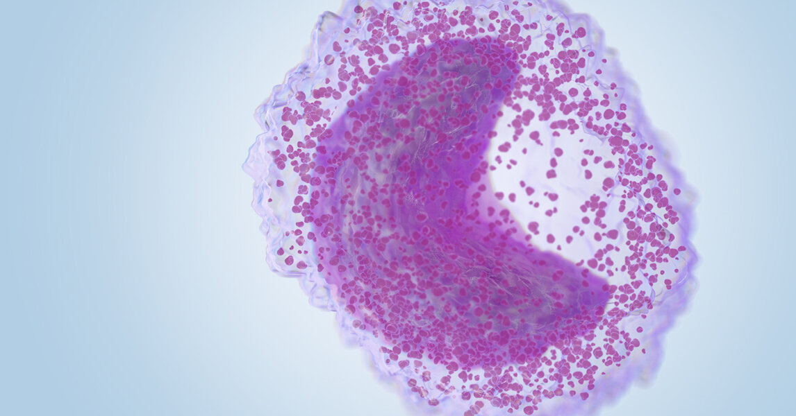 Interpreting Immature Granulocyte Levels