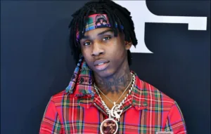 polo g teeth 1