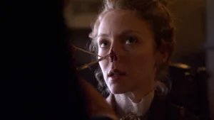 syphilis nose 1686907260