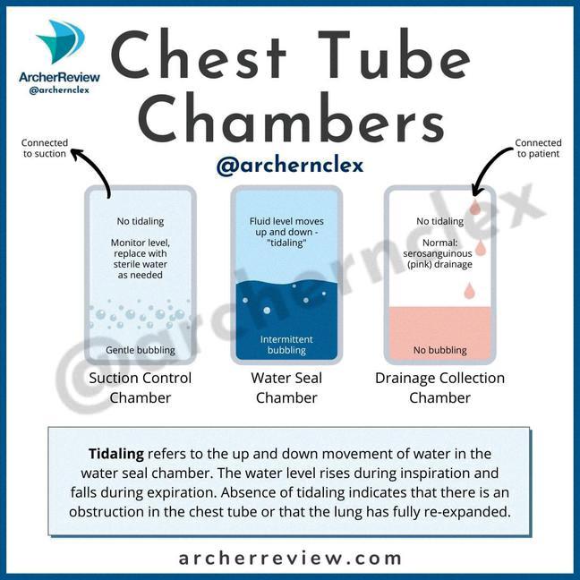 Assessment Of Tidaling In Chest Drainage Units