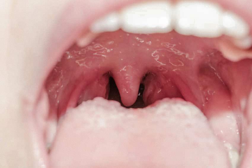 tongue touching uvula