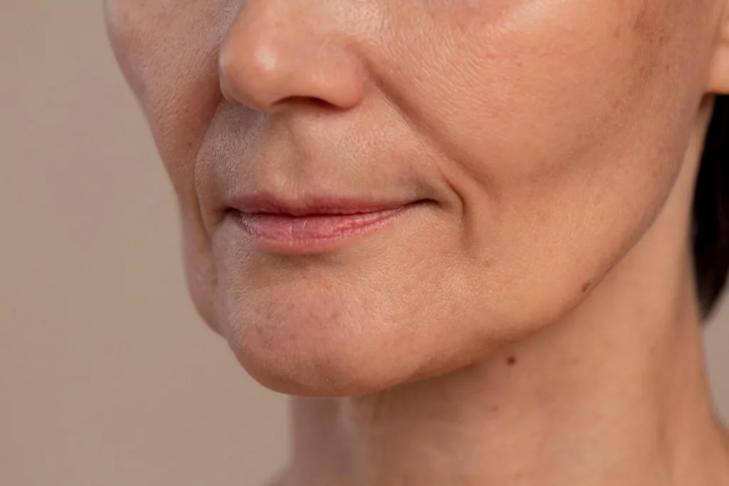 Botox Help Reduce Lip Wrinkles
