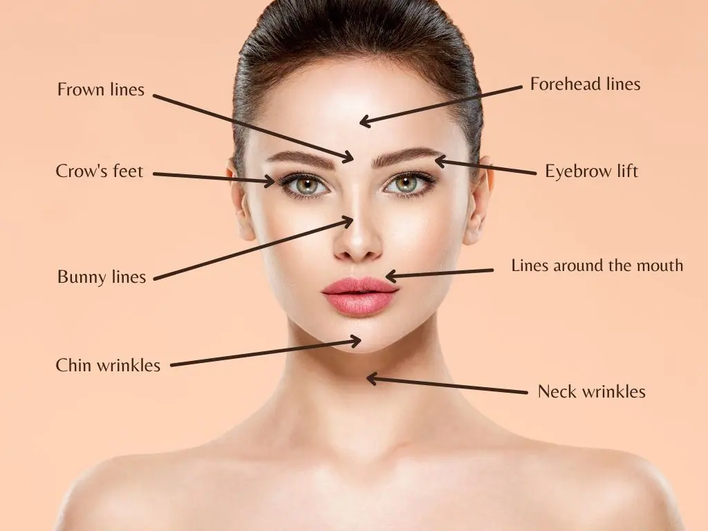 indications for Botox injections